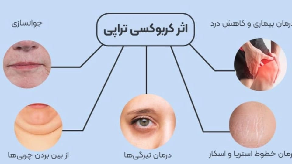 قیمت دستگاه کربوکسی تراپی صورت